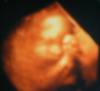Ultrasound shows baby in the womb of one of LifeSavers Ministries' clients