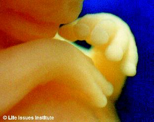 A baby's hands at seven weeks from conception (about the age of Sondra's baby).